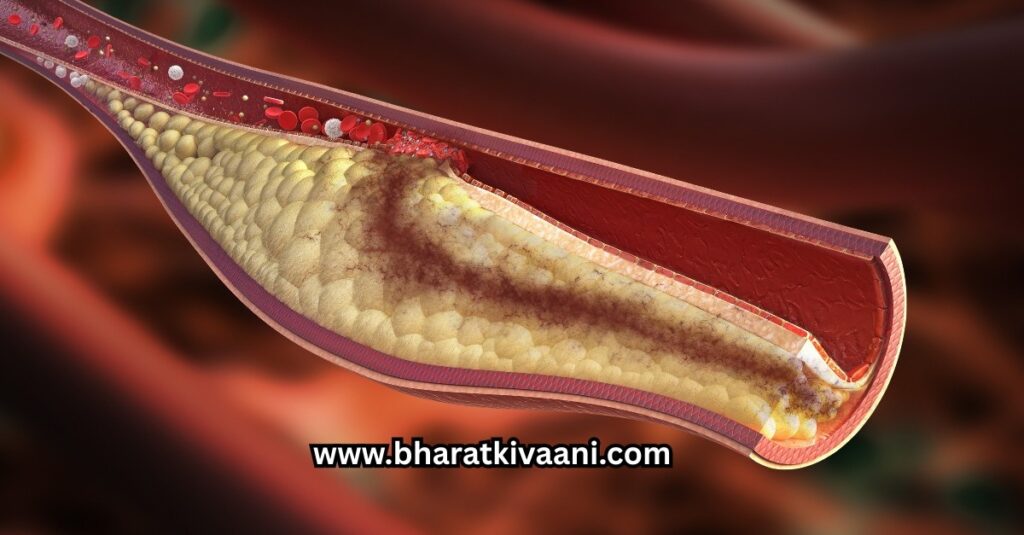 कोलेस्ट्रॉल कम करने के उपाय जो वास्तव में काम करते हैं